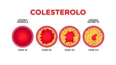 slide-Come-abbassare-i-livelli-di-colesterolo-nel-sangue-con-gli-integratori